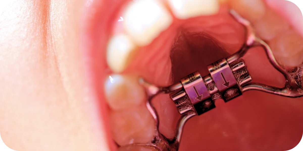 disjoncteur-docteurs-choquet-proche-orleans