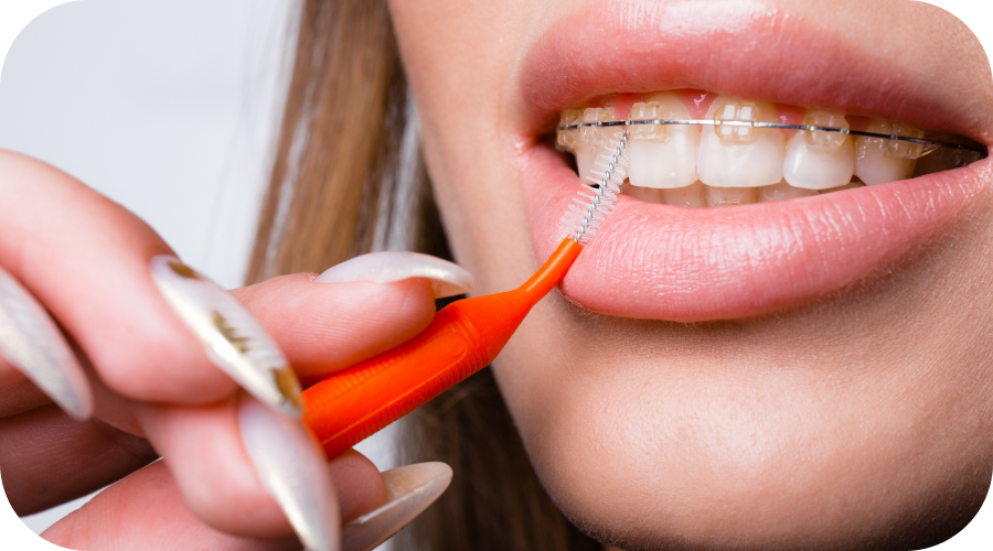 brossage-appareils-dentaire-orleans