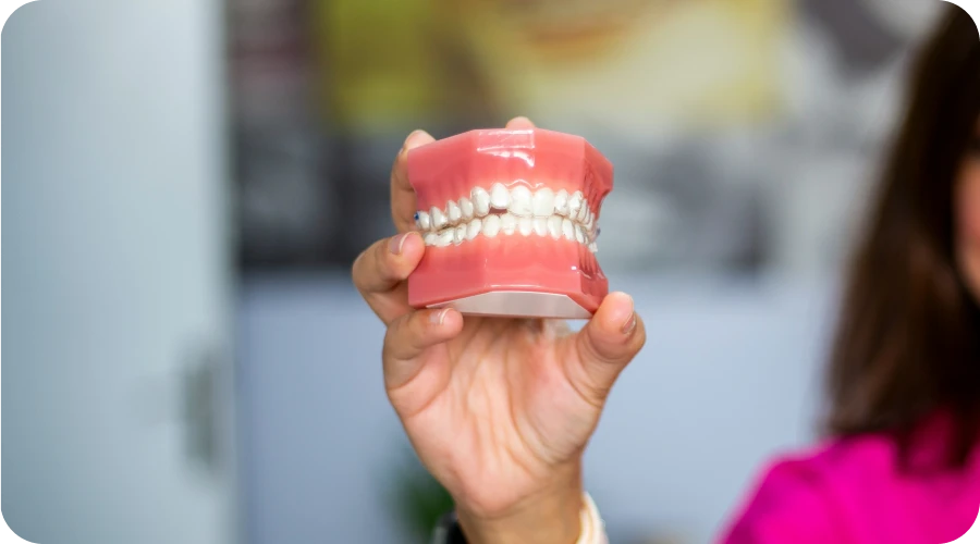 Modèle dentaire présentant des gouttières orthodontiques au cabinet dentaire du Dr Choquet près d'Orléans